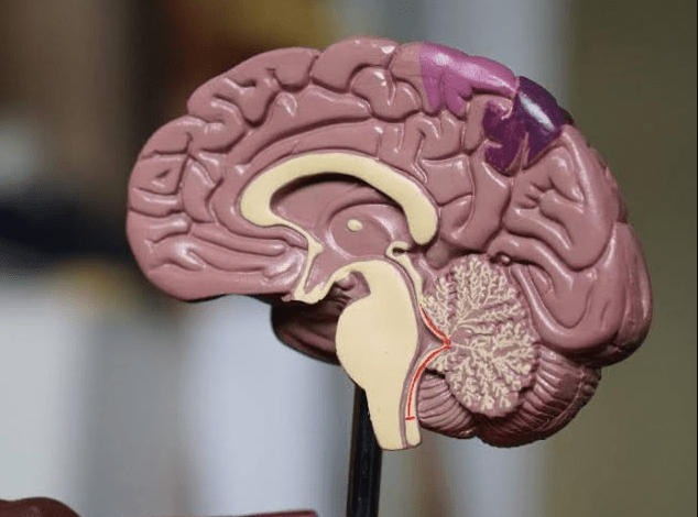 5 Penyebab Tumor Otak yang Harus Diwaspadai
